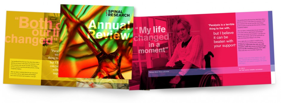 Spinal Research AnnReview-2012 concept